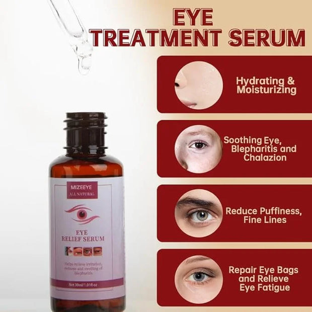 Chalazion Eye Treatment For Blepharitis, 2 PCS Moisturize Eyelids Serum and Chalazion Remover, Gentle Under Eye Relief Ser...