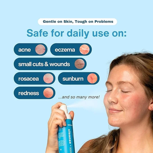 Hypochlorous Acid Spray – Eyelid Cleanser, HOCl Face & Skin Mist for Acne, Eczema & Irritation – Multi-Purpose Skin Repair...