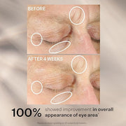 StriVectin Anti-Wrinkle Intensive Eye Cream Concentrate for Wrinkles PLUS, Targets Crow's Feet, Firmness, Puffiness and Da...