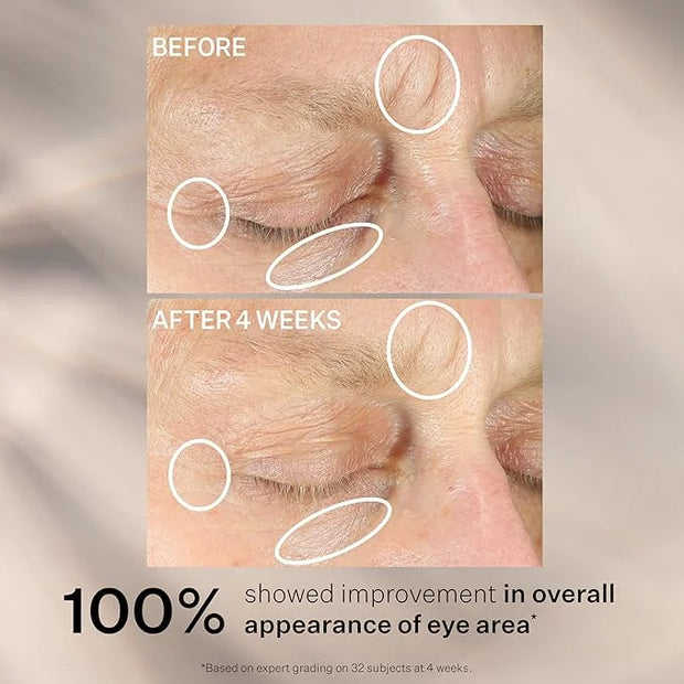 StriVectin Anti-Wrinkle Intensive Eye Cream Concentrate for Wrinkles PLUS, Targets Crow's Feet, Firmness, Puffiness and Da...