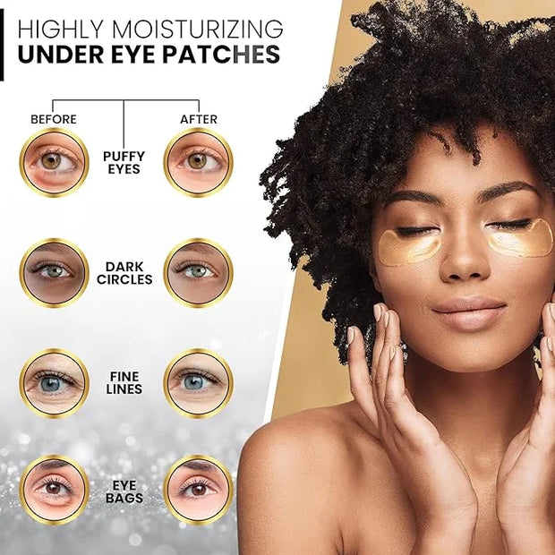 Under Eye Patches for Dark Circles and Puffiness – 24 Collagen Pairs for Puffy Eyes, Wrinkles & Bags – Gold Gel Eye Mask V...