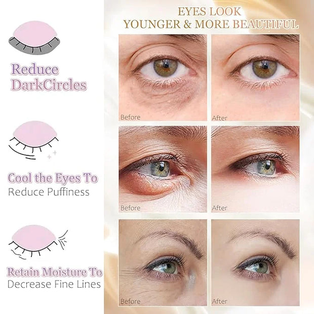 MOND'SUB Premium Under Eye Patches, Gel Eye Patches Hydrating & Refresh for Puffy Eyes, Under Eye Bags & Dark Circles, Nat...