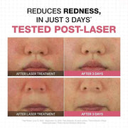 Physiogel Moisturizer Cream, Reduces Redness in just 3 days, Hydration for Dry & Sensitive Skin, Korean skin care, Fragran...