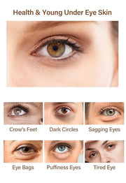 Caffeine Eye Serum Under Eye Treatment Serum for Moisturizing Anti-Aging Brightening Eye Serum, Caffeine Cream for Wrinkle...