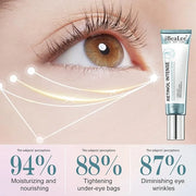 Retinol Eye Cream for Dark Circles & Wrinkles–Brighten & Smooth– Anti-Aging Under Eye Treatment with Retinol & Hyaluronic ...