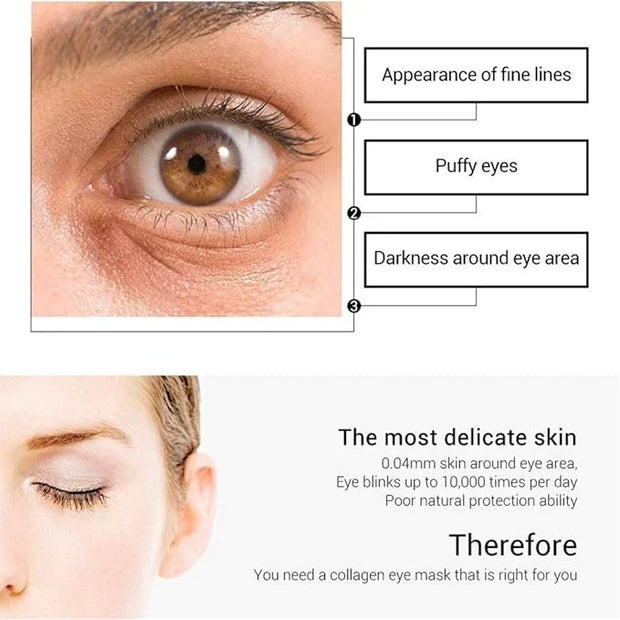 Under Eye Patches - 30 Pairs Collagen Eye Mask Eye Patches for Puffy Eyes and Dark Circles, Anti Aging Moisturizing Gel Ey...