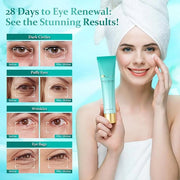 Advanced Eye Cream for Dark Circles - Targeted Solution for Wrinkles, Puffiness, and Firmness - Proven Efficacy with Cynan...