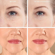 20X Reusable Expression Line Smoothing, Medical-Grade Silicone for Overnight Wrinkle Reduction & Anti-Aging Hydration, Bea...