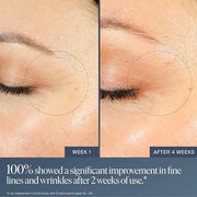 Summer Fridays Jet Lag Overnight Eye Serum - Nourishing Undereye Treatment for Dark Circles - Helps to Hydrate, Smooth, Fi...
