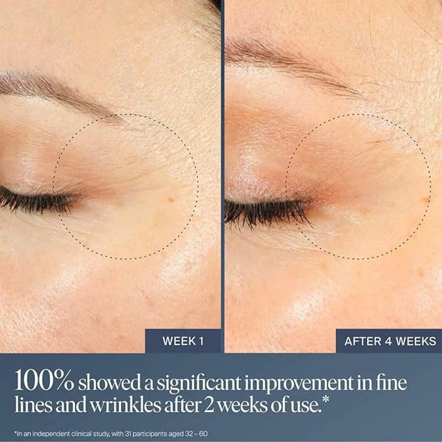 Summer Fridays Jet Lag Overnight Eye Serum - Nourishing Undereye Treatment for Dark Circles - Helps to Hydrate, Smooth, Fi...