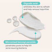 Proactiv 3 Step Acne Treatment w/ Pimple Patches - Benzoyl Peroxide Face Wash, Repairing Acne Spot Treatment for Face and ...