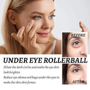 Eye Roller for Puffy Eyes, Castor Oil and Frankincense Eye Roller for Dark Circles, and Wrinkles, Anti Aging Eye Serum Cre...