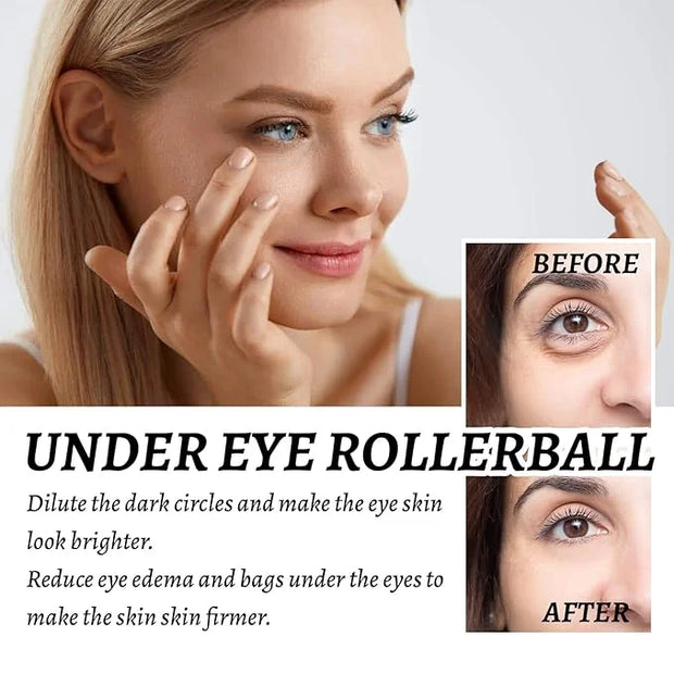 Eye Roller for Puffy Eyes, Castor Oil and Frankincense Eye Roller for Dark Circles, and Wrinkles, Anti Aging Eye Serum Cre...