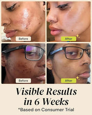 Gleamin Brightening Skincare Bundle – Mask, Serum, Cleanser, Moisturizer & Oil for Dark Spots, Uneven Tone, and Glowing Sk...