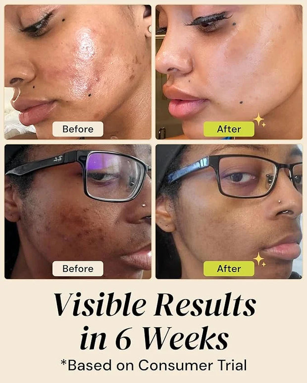 Gleamin Brightening Skincare Bundle – Mask, Serum, Cleanser, Moisturizer & Oil for Dark Spots, Uneven Tone, and Glowing Sk...
