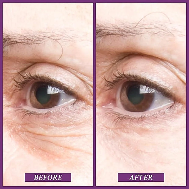 PRAI Beauty Ageless Eye Tight Uplift Serum, Anti-Aging and Hydrating Eye Serum, For Instantly Ageless Brow and Eyelid Area...