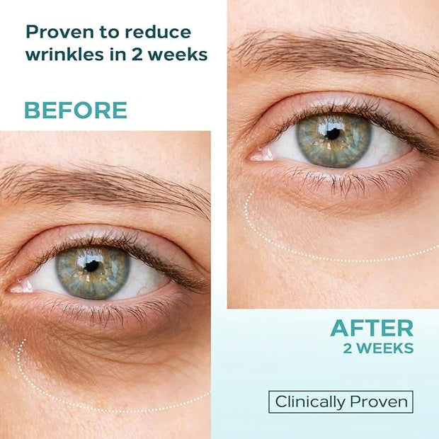 Eye Cream for Dark Circles & Puffiness – Dual Retinol + 5-Peptide Complex with Stem Cell Extract – Anti-Aging & Moisturizi...