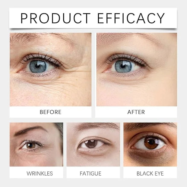 Under Eye Cream Dark Circles, Under Eye Skin Treatment Cream Reduces Puffiness, Fine Lines, Wrinkles and Eye Bags, Day & N...