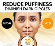 Stylia Under Eye Patches for Dark Circles and Puffy Eyes (30 Pairs) - 24k Gold Under Eye Mask with Vitamin C, Hyaluronic A...