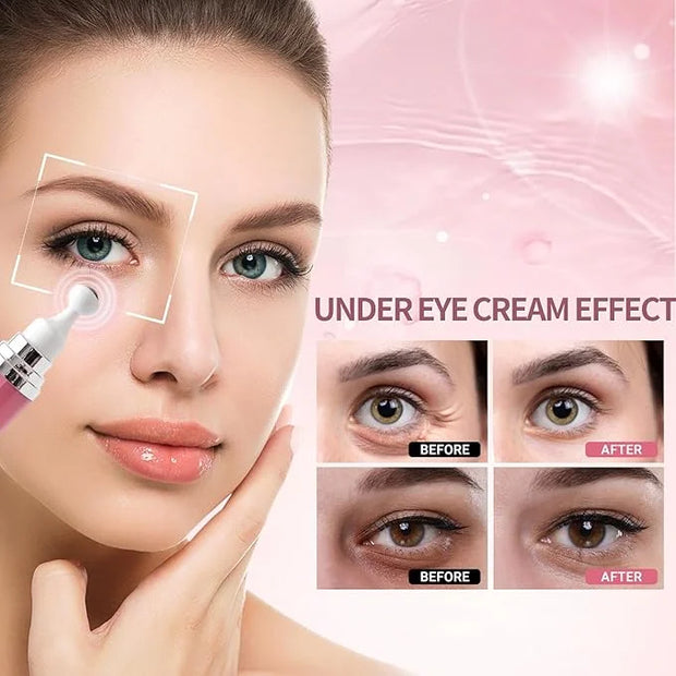 Caffeine Eye Cream for Dark Circles and Puffiness,Under Eye Cream for Fine Lines Wrinkles and Bags,Eye Care Eye Roller Ser...