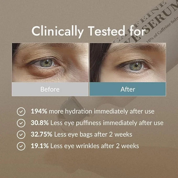Hydro Boost Caffeine Eye Serum (0.33 fl.oz./10ml) With 10% Caffeine Solution Niacinamide & Hexapeptide-8 Depuff Elasticity...