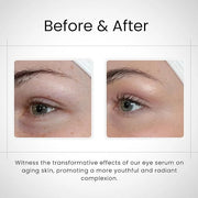 Organic Eye Oil Serum, Under Eye Brightener, Under Eye Serum for Eye Bags, Puffy Eyes Treatment, Dark Circles Under Eye Tr...