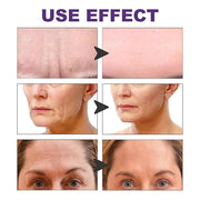 100 Pcs Face Tape for Wrinkles Lasting Face Lift Tape Overnight Invisible Silicone Face and Forehead Wrinkle Patches Neck ...