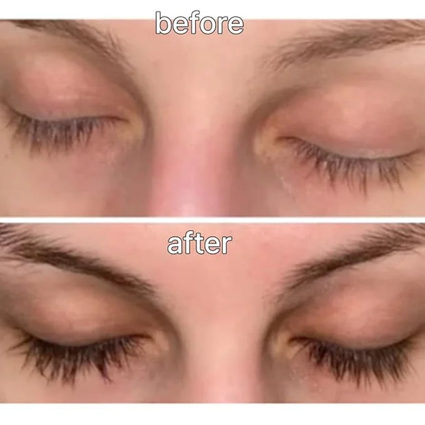Biotin Lash Serum - Eyelash and Eyebrow Growth Serum for Thicker, Fuller Lashes and Brows, Korean Dermatologist-Developed,...