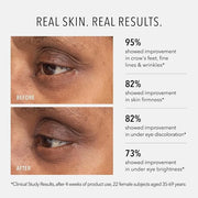 HydroPeptide Retinol Eye Renewal Lifting & Firming Eye Balm with 0.65% Universal Tri-Retinol Complex Peptide Solution, 0.5...