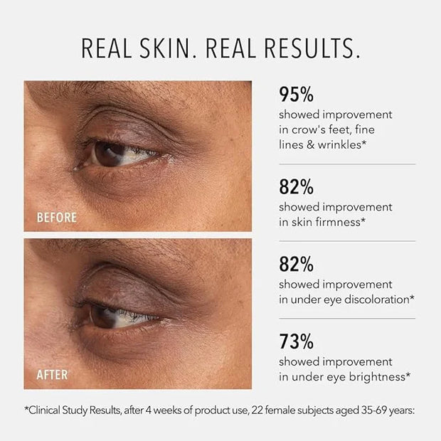 HydroPeptide Retinol Eye Renewal Lifting & Firming Eye Balm with 0.65% Universal Tri-Retinol Complex Peptide Solution, 0.5...
