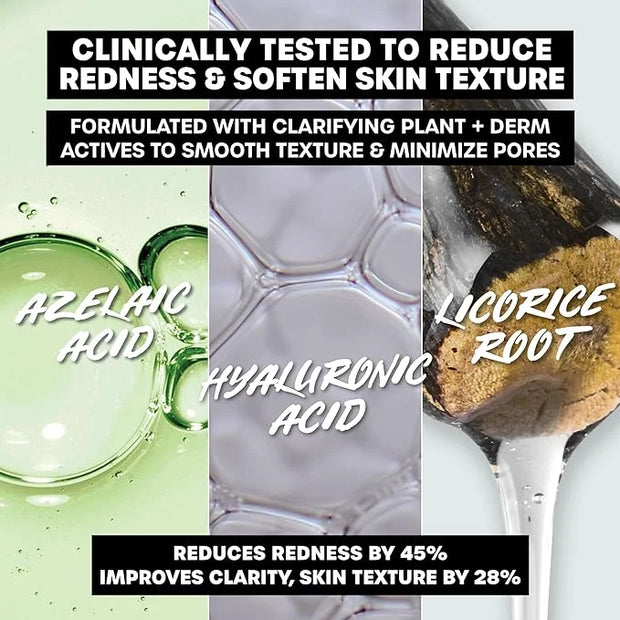 THAYERS Let's Be Clear Water Face Cream, Moisturizer with Azelaic Acid and Hyaluronic Acid, Skin Care for Combination to O...