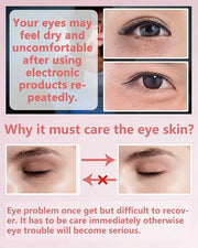 Under Eye Patches (60Pcs) - Update Eye Mask Rose Extract, Eye Treatment Mask, Under Eye Bag Treatment, Eye Mask for Puffy ...