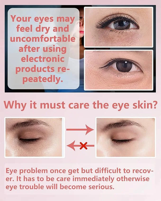 Under Eye Patches (60Pcs) - Update Eye Mask Rose Extract, Eye Treatment Mask, Under Eye Bag Treatment, Eye Mask for Puffy ...