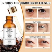 Caffeine Eye Serum with EGCG, 2 PCS 5% Caffeine Solution Reduces Pigmentation and Puffiness, Under Eye Serum for Dark Circ...