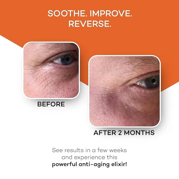 Zocufill Elixir Eye Gel and Face Serum - Eye Bags Treatment for Women and Men - Reduce the Appearance of Dark Circles, Puf...