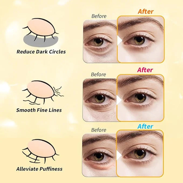 Under Eye Patches(24 Pairs), 24K Gold, Caffeine, Retinol Eye Masks for Puffy Eyes, Wrinkles, Dark Circles, Undereye Bags T...