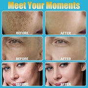 Home Use Microneedling Microneedle Skin Care Beauty Kit Tool for Face Hair Beard - Product Image