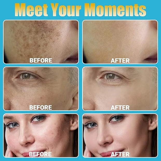 Home Use Microneedling Microneedle Skin Care Beauty Kit Tool for Face Hair Beard - Product Image