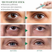 Retinol Eye Stick Balm, Retinol Eye Cream – Anti-Aging Formula Reduces Fine Lines, Dark Circles & Puffiness, Hydrates Deli...
