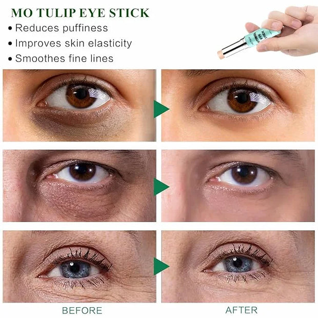 Retinol Eye Stick Balm, Retinol Eye Cream – Anti-Aging Formula Reduces Fine Lines, Dark Circles & Puffiness, Hydrates Deli...