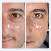 Geologie Anti-Aging Eye Cream | Treats Visible Signs of Aging | Reduce Fine Lines & Wrinkles | Retinol, Caffeine, Peptides...