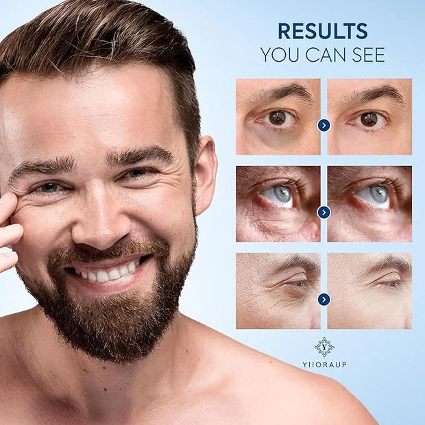 Caffeine Eye Cream for Men: Under Eye Roller for Bags and Puffy Eyes Treatment - Men's Cooling Stick and Depuffer for Dark...