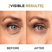 Moisturizing Eye Cream w/Aloe Vera, Collagen, Hyaluronic Acid, Cotton Stem Cells for Dark Circles, Puffiness & Bags - Unde...