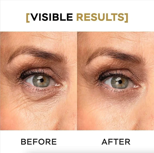 Moisturizing Eye Cream w/Aloe Vera, Collagen, Hyaluronic Acid, Cotton Stem Cells for Dark Circles, Puffiness & Bags - Unde...
