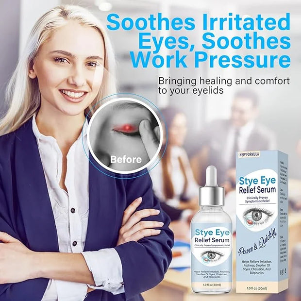 Stye Eye Treatment, Natural Stye Treatment Serum for Styes Chalazion and Blepharitis, Mild & Fast Relief - Product Image
