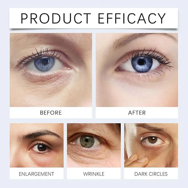 Retinol Under Eye Cream, Anti-aging Eye Cream for Eye Bags, Retinol Eye Cream for Dark Circles, Puffiness and Wrinkles, Su...