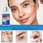 Stye Eye Treatment, Natural Stye Remover, Eye Stye Relief Serum, Premium Formula - Gentle Cleanser for Chalazion & Blephar...
