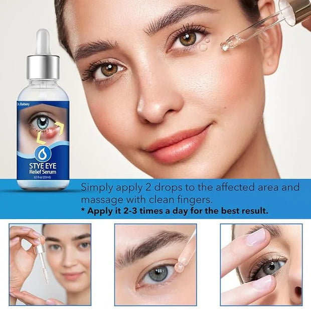 Stye Eye Treatment, Natural Stye Remover, Eye Stye Relief Serum, Premium Formula - Gentle Cleanser for Chalazion & Blephar...