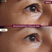 Under Eye Patches Booster Pomegranate &10ml Serum –12 Pairs for Puffy Eyes Dark Circles Eye Bags Anti-Wrinkle Collagen Ret...