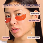 SpaLife Beauty Bright Eyed Undereye Masks – Hydrogel Eye Patches for Dark Circles, Puffiness, & Dullness with Vitamin E, G...